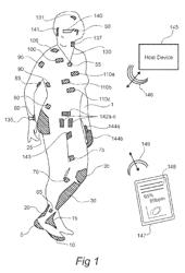 MONITORING AND MANAGEMENT OF PHYSIOLOGIC PARAMETERS OF A SUBJECT